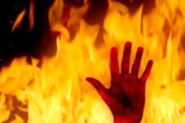 شوخی خطرناک باعث آتش‌سوزی نوجوانی در جشن تولدش شد